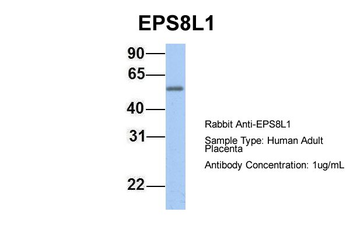 EPS8L1 Rabbit Polyclonal Antibody