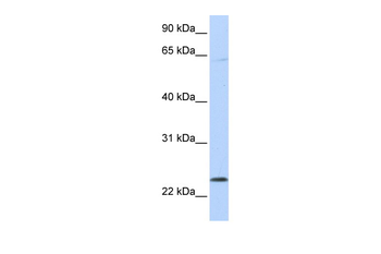 CHAC1 Rabbit Polyclonal Antibody