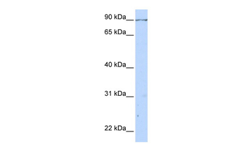 CALD1 Rabbit Polyclonal Antibody