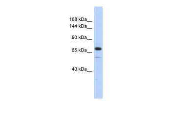 CALD1 Rabbit Polyclonal Antibody