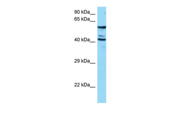 ESAM Rabbit Polyclonal Antibody