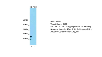 CRB3 Rabbit Polyclonal Antibody