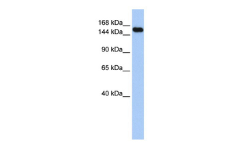 UBE3A Rabbit Polyclonal Antibody