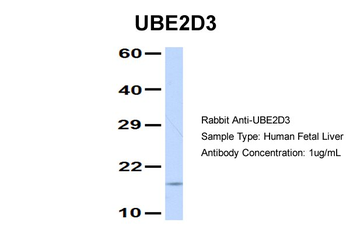UBE2D3 Rabbit Polyclonal Antibody