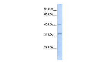 STUB1 Rabbit Polyclonal Antibody