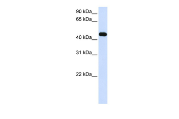 MKRN2 Rabbit Polyclonal Antibody