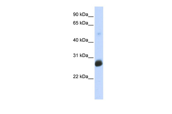 RNF186 Rabbit Polyclonal Antibody