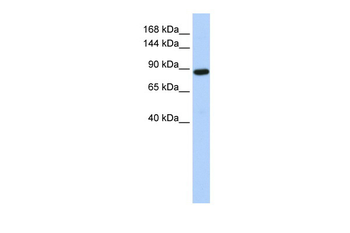 HACE1 Rabbit Polyclonal Antibody