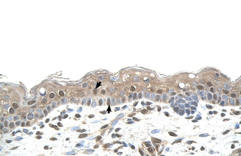 RNF25 Rabbit Polyclonal Antibody