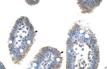 UBE2J2 Rabbit Polyclonal Antibody