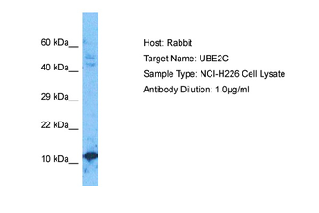 UBE2C Rabbit Polyclonal Antibody