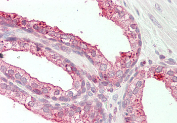 TSPAN1 Rabbit Polyclonal Antibody