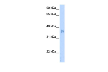 NOV Rabbit Polyclonal Antibody