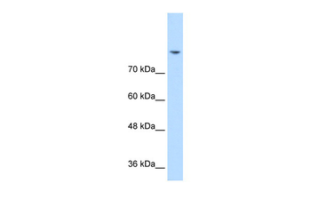DLG2 Rabbit Polyclonal Antibody