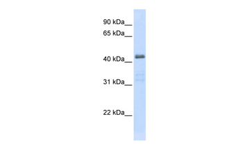 SLC29A2 Rabbit Polyclonal Antibody