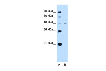 SLC16A1 Rabbit Polyclonal Antibody