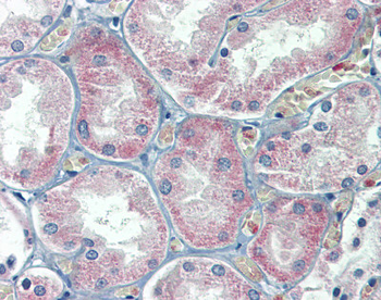 SLC27A2 Rabbit Polyclonal Antibody