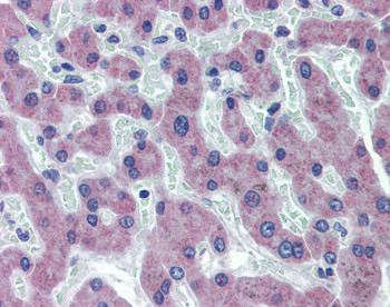 SLC27A2 Rabbit Polyclonal Antibody