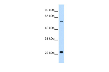 SLC17A5 Rabbit Polyclonal Antibody
