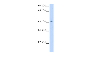 SLC25A24 Rabbit Polyclonal Antibody