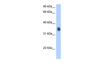 SLC35F2 Rabbit Polyclonal Antibody