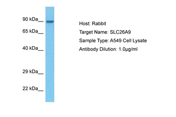 SLC26A9 Rabbit Polyclonal Antibody