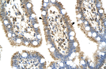 C8B Rabbit Polyclonal Antibody