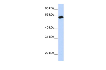 GHR Rabbit Polyclonal Antibody