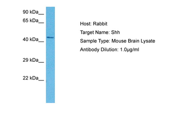 SHH Rabbit Polyclonal Antibody