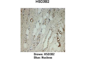 HSD3B2 Rabbit Polyclonal Antibody