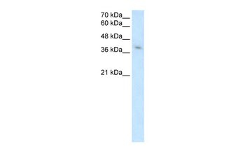 MICA Rabbit Polyclonal Antibody
