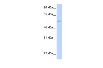 UGT1A1 Rabbit Polyclonal Antibody