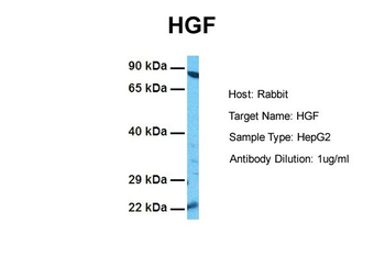HGF Rabbit Polyclonal Antibody