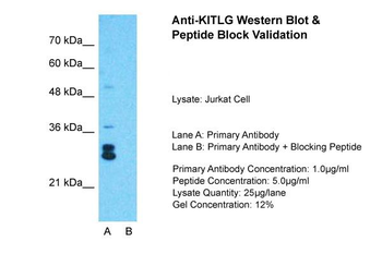 KITLG Rabbit Polyclonal Antibody
