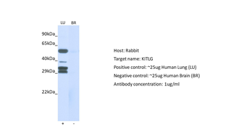 KITLG Rabbit Polyclonal Antibody