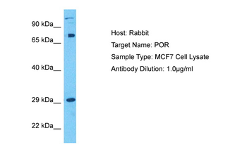 POR Rabbit Polyclonal Antibody