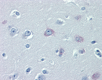 TRPM2 Rabbit Polyclonal Antibody