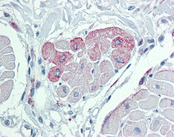 TRPM2 Rabbit Polyclonal Antibody