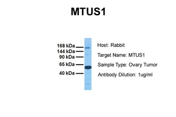 MTUS1 Rabbit Polyclonal Antibody