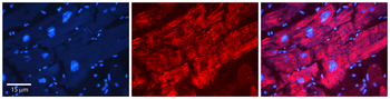 AGPAT2 Rabbit Polyclonal Antibody