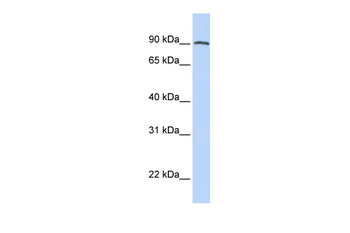 FOLH1 Rabbit Polyclonal Antibody
