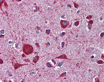LRP8 Rabbit Polyclonal Antibody