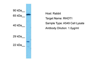 RHOT1 Rabbit Polyclonal Antibody