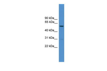 Dct Rabbit Polyclonal Antibody