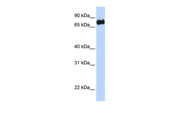 LRCH4 Rabbit Polyclonal Antibody