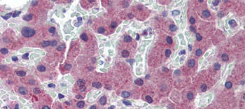 TFR2 Rabbit Polyclonal Antibody