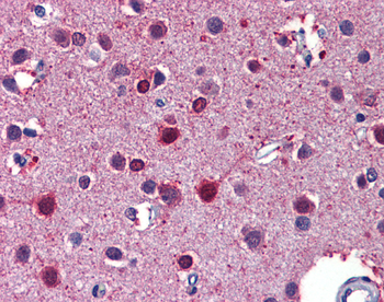 RARB Rabbit Polyclonal Antibody