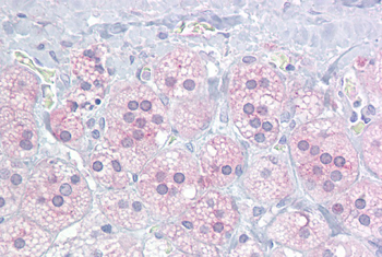 NR5A1 Rabbit Polyclonal Antibody