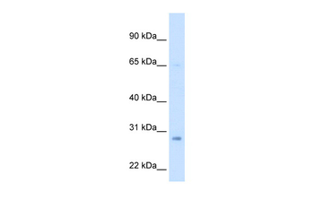 ECHS1 Rabbit Polyclonal Antibody