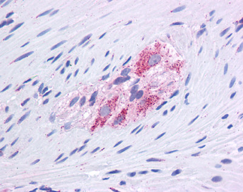 GLUD1 Rabbit Polyclonal Antibody